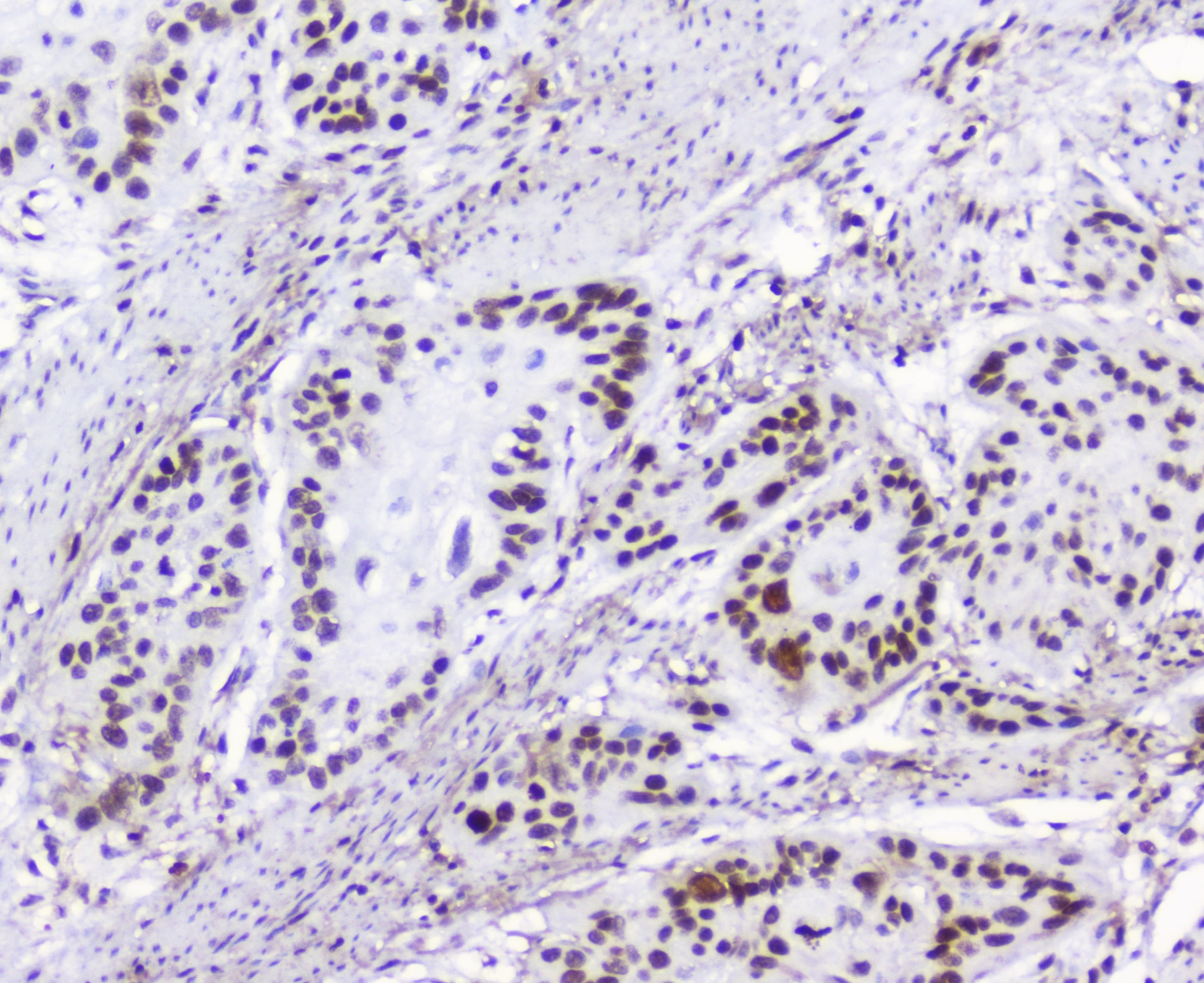 HMGN2 Antibody