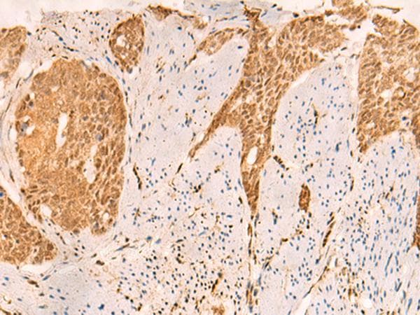 SETD1A / SET1 Antibody