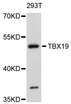 Polyclonal Rabbit anti-Human TBX19 / TPIT Antibody (WB)