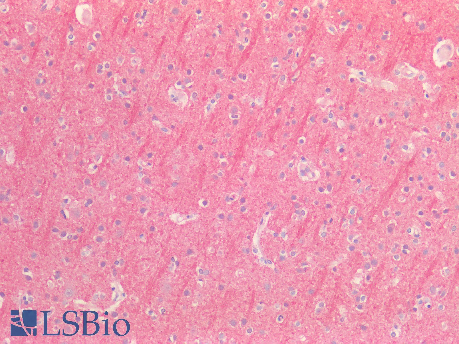 IHC-plus™ BCL2L2 / Bcl-w Antibody (aa2-193)