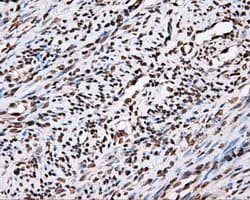 APP / Beta Amyloid Precursor Antibody (clone OTI2B10)