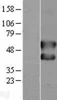 Human FOS / c-FOS Protein (Over-Expression Lysate Myc-DDK (Flag))