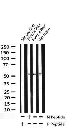 TP53 / p53 Antibody (phospho-Ser15)