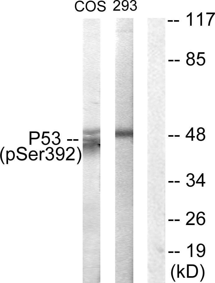 TP53 / p53 Antibody (phospho-Ser392)