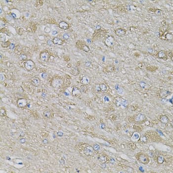 Polyclonal Rabbit anti-Human EIF3H / EIF3S3 Antibody (IHC, IF, WB)