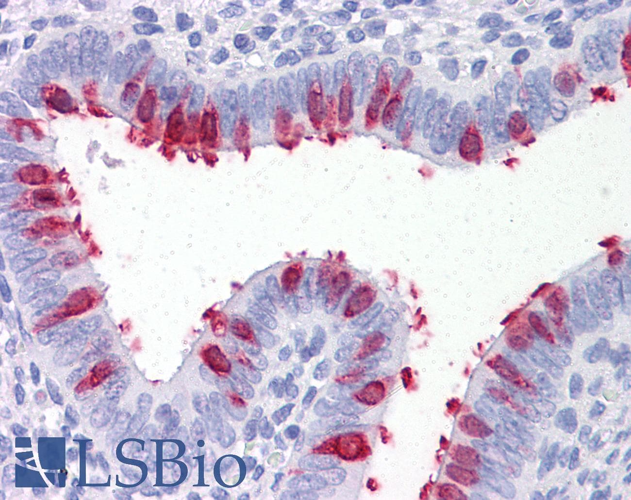 IHC-plus™ ARVCF Antibody (clone 5D2)