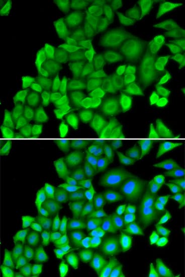 Polyclonal Rabbit anti-Human PSMB4 Antibody (IHC, IF, WB)