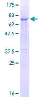Human CTSC / Cathepsin C / JP Protein (Recombinant GST)