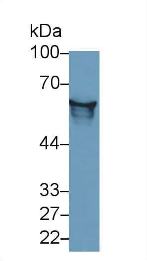 AGT / Angiotensinogen Antibody (aa25-477)