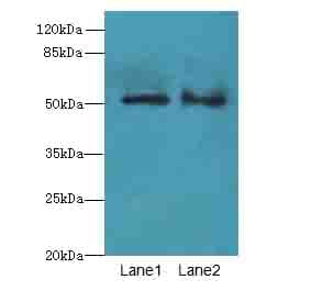 SLC30A6 Antibody