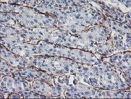 ARH / LDLRAP1 Antibody (clone OTI7E11)