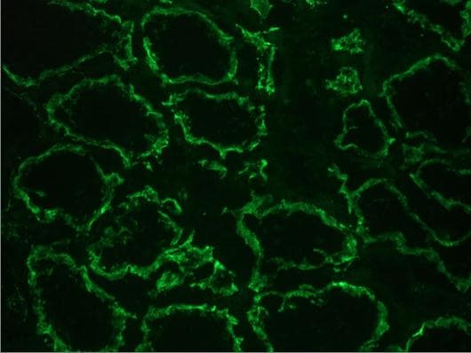 IHC-plus™ CDH6 / K Cadherin Antibody (clone 2B6)