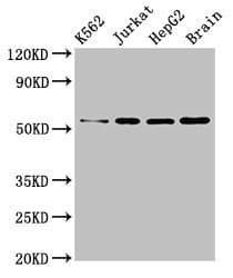 Polyclonal Rabbit anti-Human SLC16A8 Antibody (IHC, IF, WB)