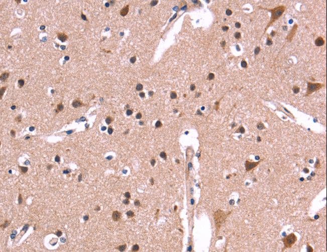 Polyclonal Rabbit anti-Human ARC / Arg3.1 Antibody (IHC)