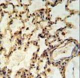 IMMP2L Antibody (aa81-109)