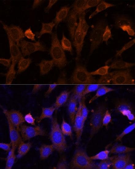 Polyclonal Rabbit anti-Human VPS36 Antibody (IF, WB)