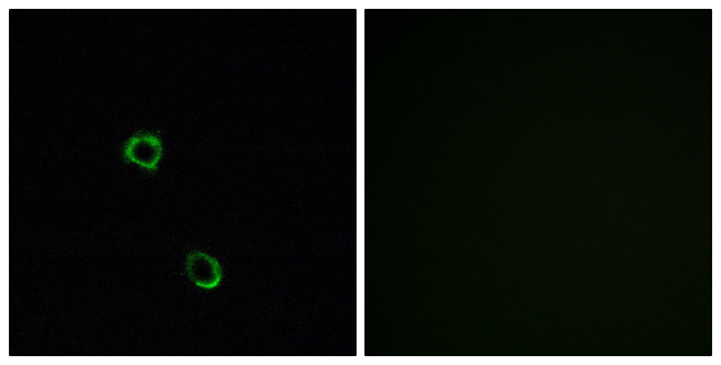 OR2M5 Antibody (aa281-330)