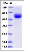 Rat TGFBR2 Protein (Recombinant Human IgG Fc, C-terminus)