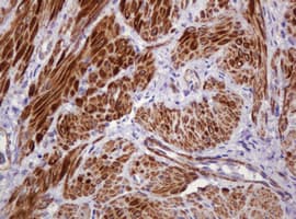 PADI4 / PAD4 Antibody (clone OTI5C10)