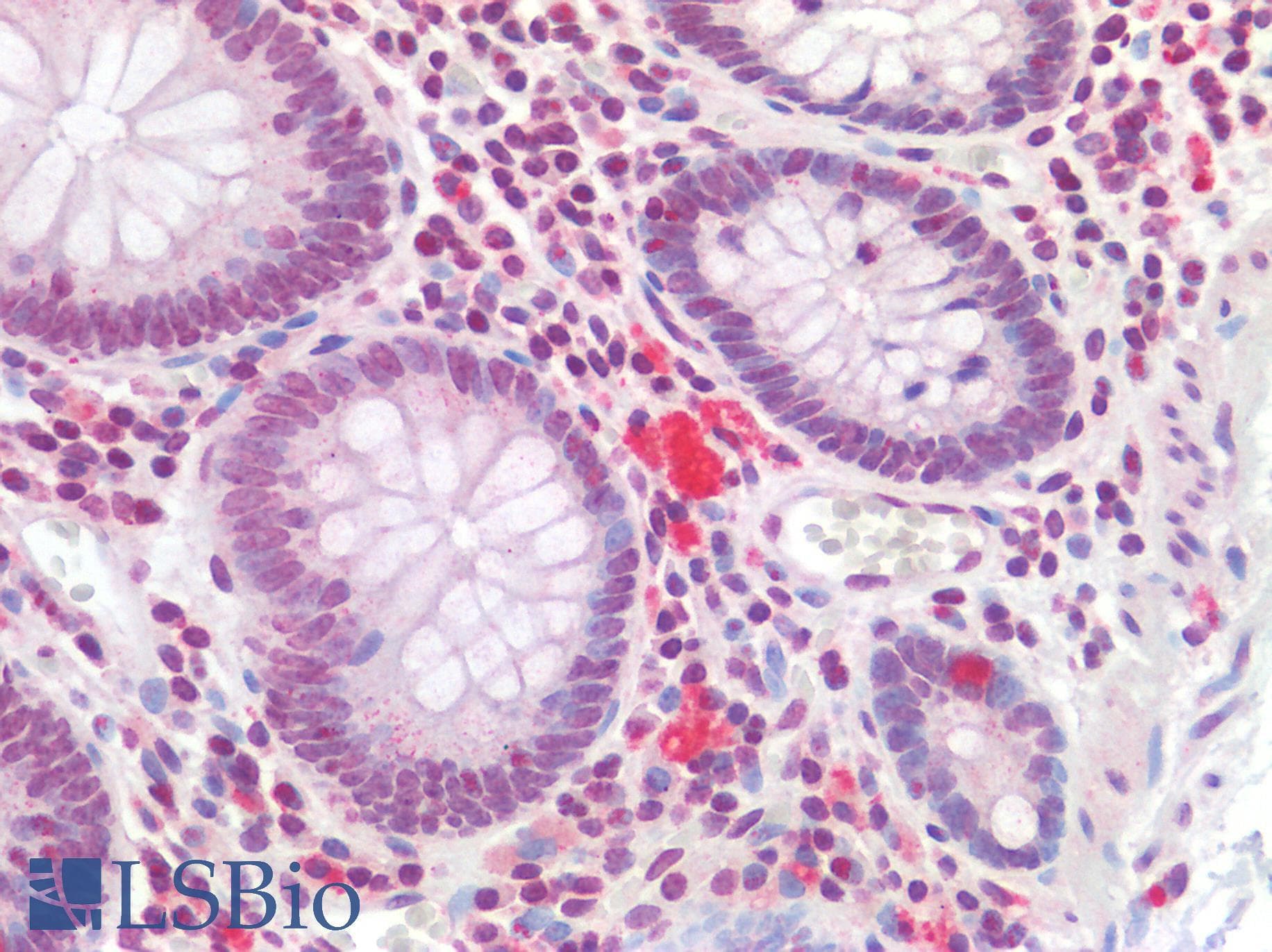 IHC-plus™ Polyclonal Rabbit anti-Human HOXA10 Antibody (IHC)