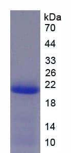 Human ADAM15 Protein (Recombinant His)
