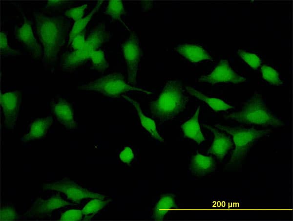 CYTH2 / Cytohesin 2 Antibody (clone 6H5)