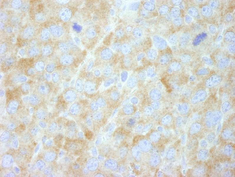 FASN / Fatty Acid Synthase Antibody (aa2462-2511)