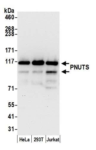 IHC-plus™ PPP1R10 / PNUTS Antibody (aa350-400)