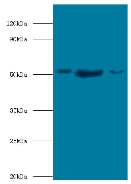 BAG5 Antibody (Biotin)