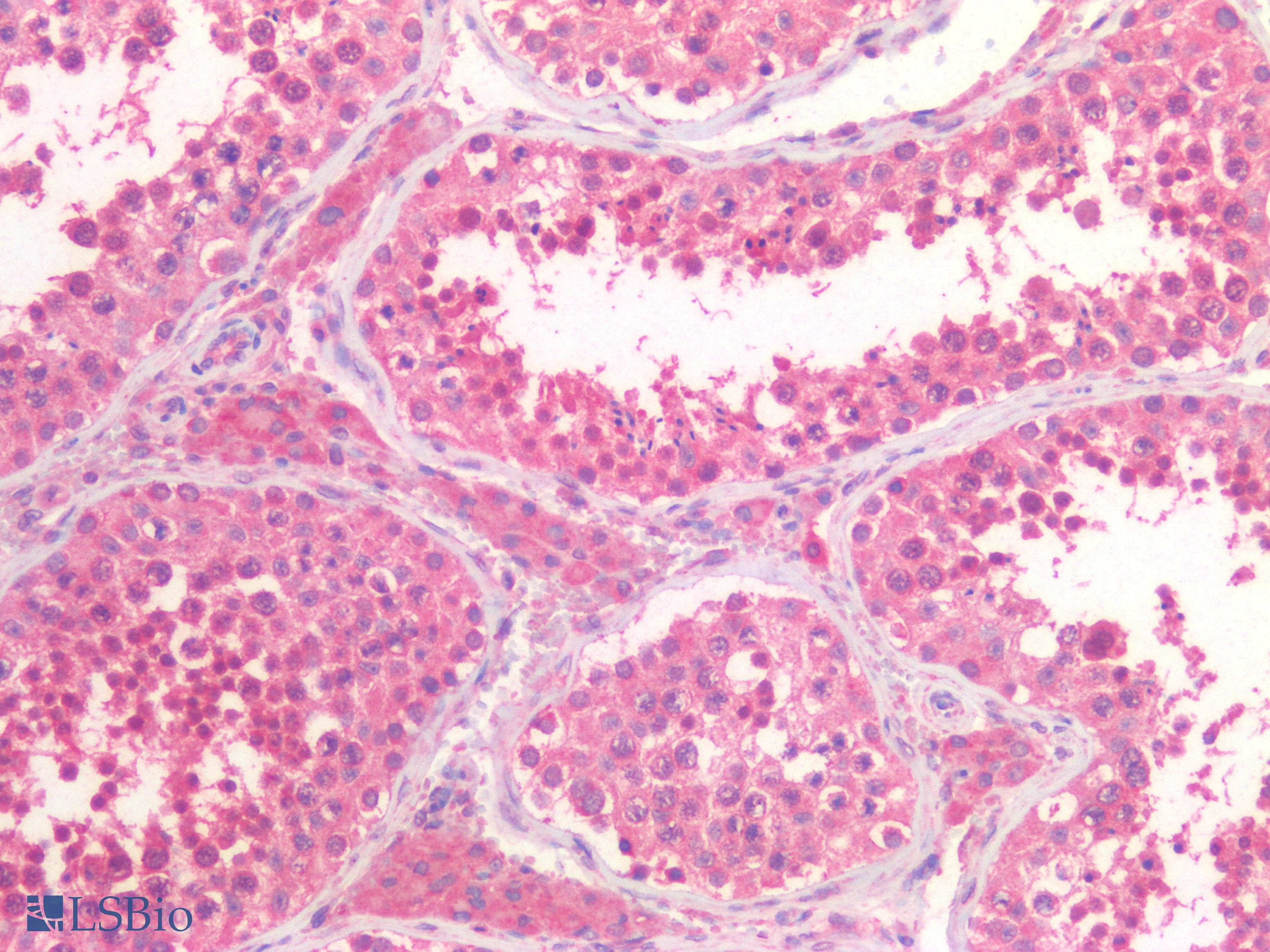 PathPlus™ Polyclonal Goat anti-Human PIK3CA / PI3K Alpha Antibody (aa800-1000, IHC)