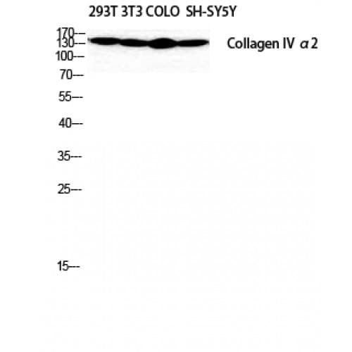 COL4A2 / Collagen IV Alpha2 Antibody (120-200 aa, N-terminal)