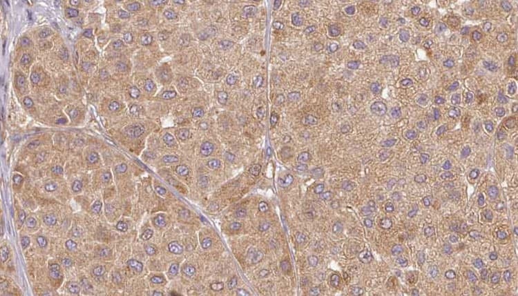 UTS2 / Urotensin II Antibody