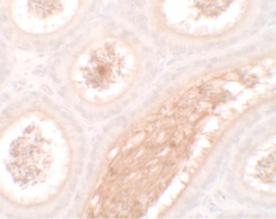 WAC Antibody