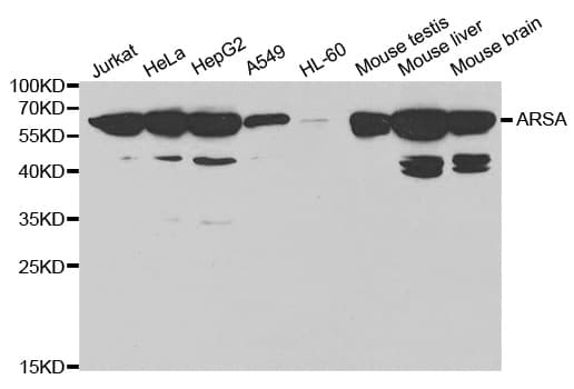 IHC-plus™ ARSA / Arylsulfatase A Antibody