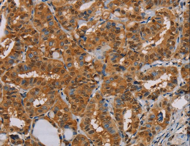 PSMC2 / RPT1 Antibody