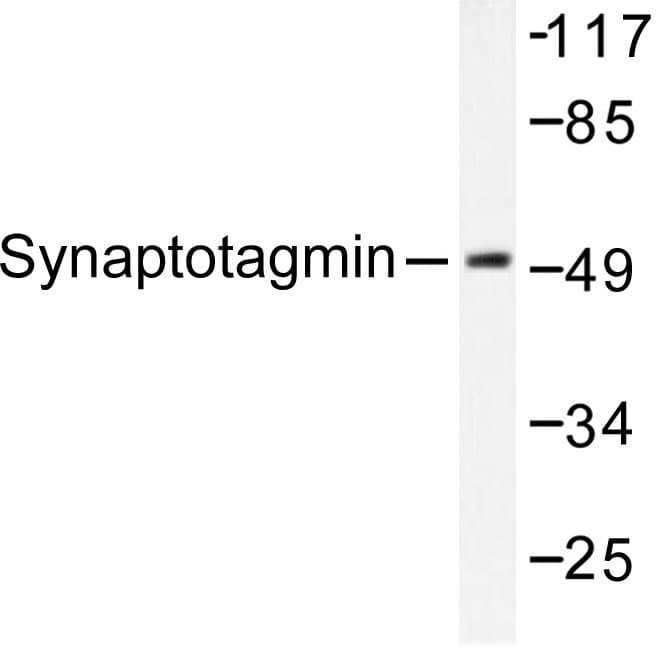 Polyclonal Rabbit anti-Human SYT1 / Synaptotagmin Antibody (Met303, IHC, WB)