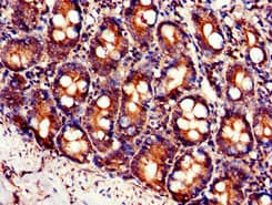 SLC7A6 Antibody