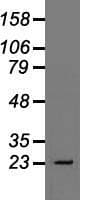 TNNI3 / Cardiac Troponin I Antibody (clone OTI4E5)