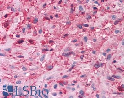 PathPlus™ CHRM3 / M3 Antibody (C-Terminus)