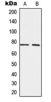 ADAM10 Antibody (Internal)