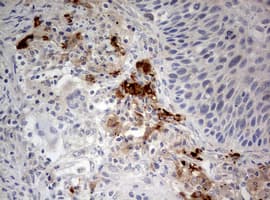 STK11 / LKB1 Antibody (aa1-236, clone OTI0A3)
