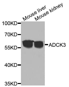 ADCK3 / CABC1 Antibody
