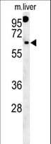 Polyclonal Rabbit anti-Human RTKN2 Antibody (aa99-127, WB)