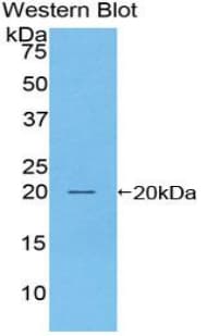 ACPP / PAP Antibody (aa56-215)