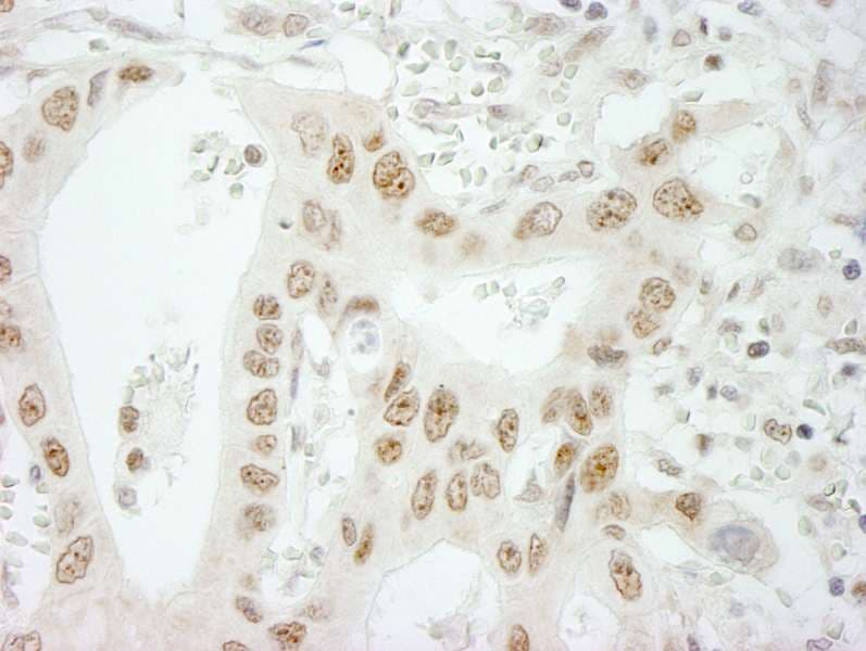 SKIV2L2 Antibody (aa100-150)