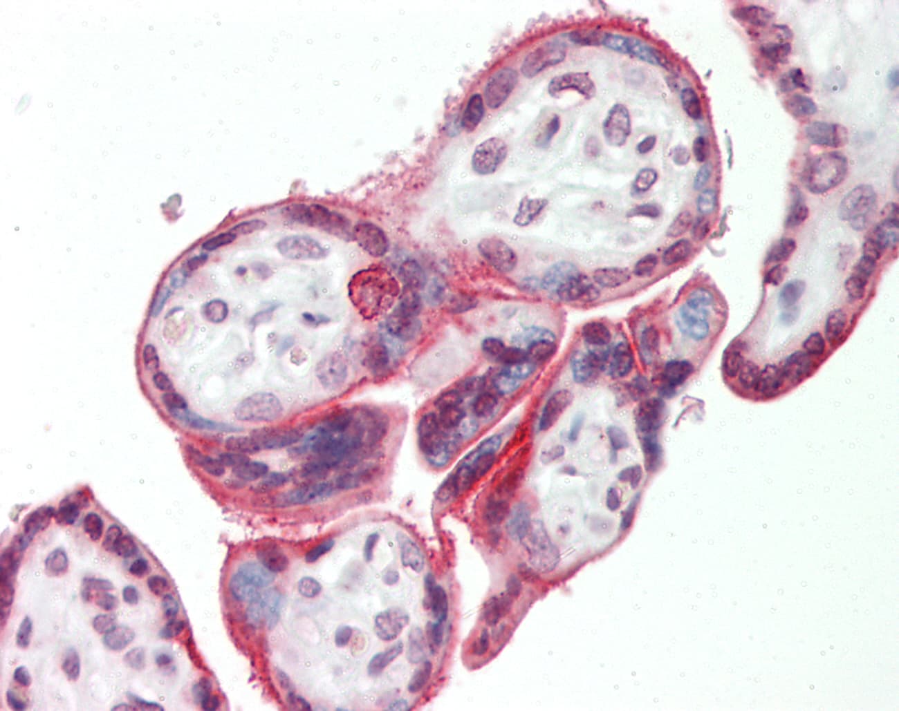 Polyclonal Rabbit anti-Human CD71 / Transferrin Receptor Antibody (aa84-133, IHC, WB)