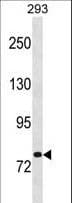Polyclonal Rabbit anti-Human CHM / REP1 Antibody (aa292-320, WB)