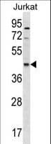 Polyclonal Rabbit anti-Human MIR16 / GDE1 Antibody (aa192-219, WB)