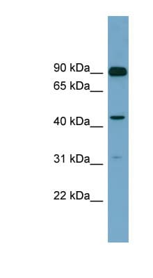 Polyclonal Rabbit anti-Human DGKA Antibody (aa107-156, WB)