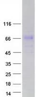 Human FAM198A Protein (Recombinant Myc-DDK (Flag))